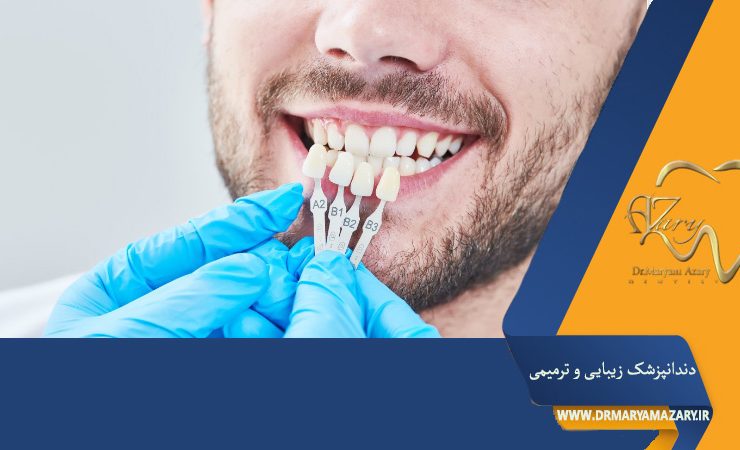 لمینت دندان و تاثیر آن بر اعتماد به نفس