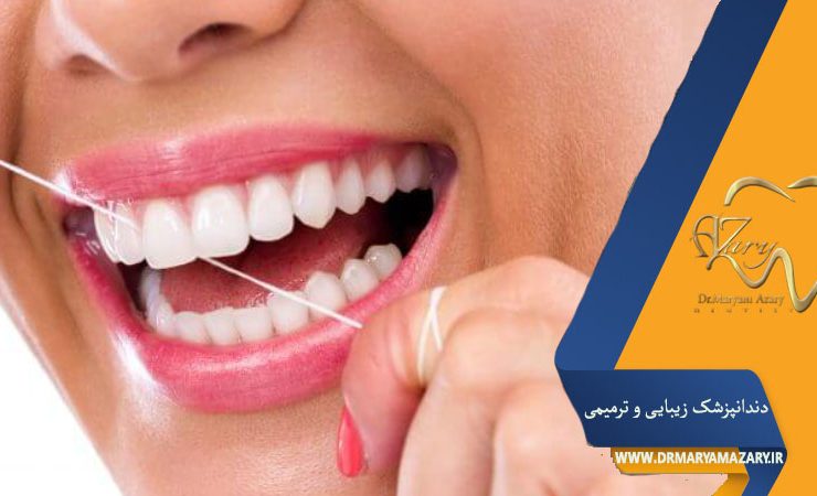 گیر غذایی بعد از ایمپلنت