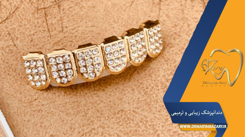 گریلز دندان طلا