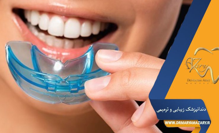 گارد دندان چیست ؟