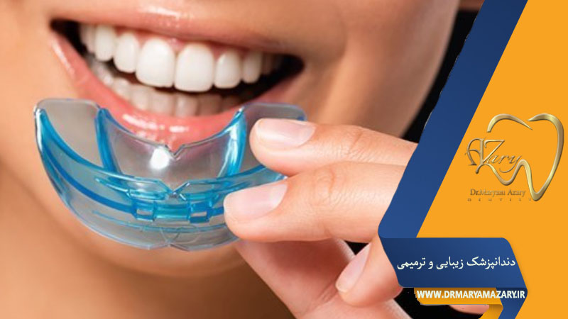 گارد دندان چیست ؟