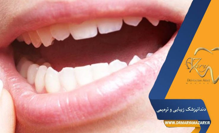 کیست دهان چیست؟