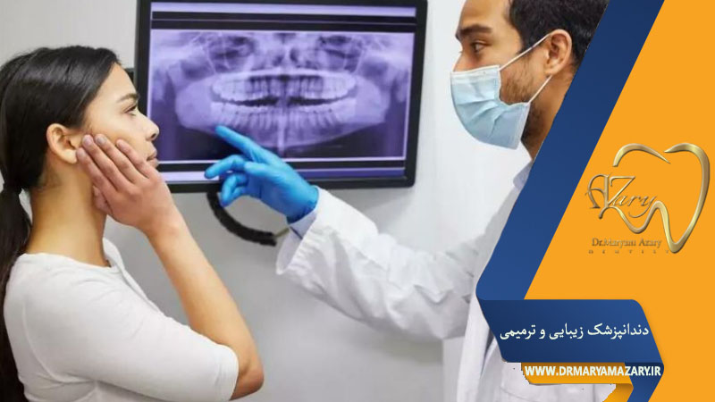 کشیدن دندان عقل چند روز درد دارد