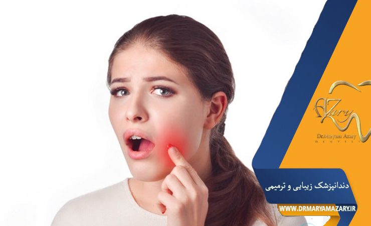 کشیدن ریشه دندان درد دارد