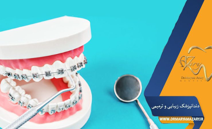 کش ارتودنسی