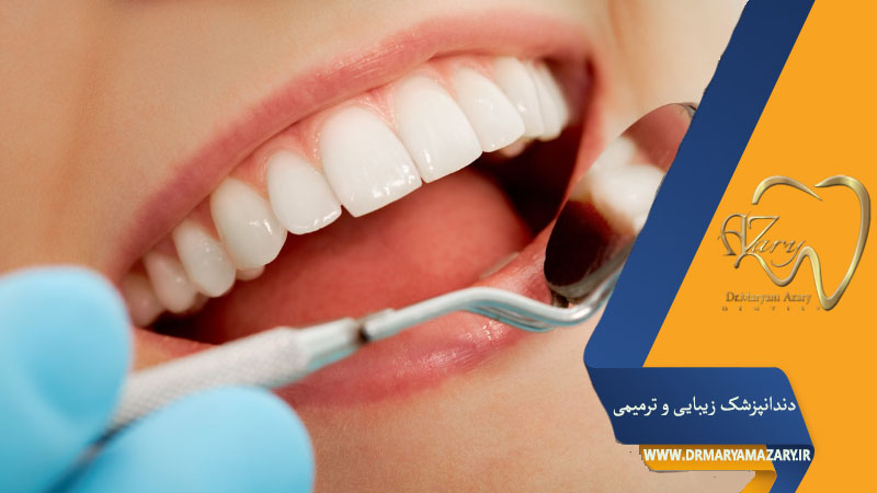 کانتورینگ دندان