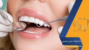 کامپوزیت و لمینت دندان