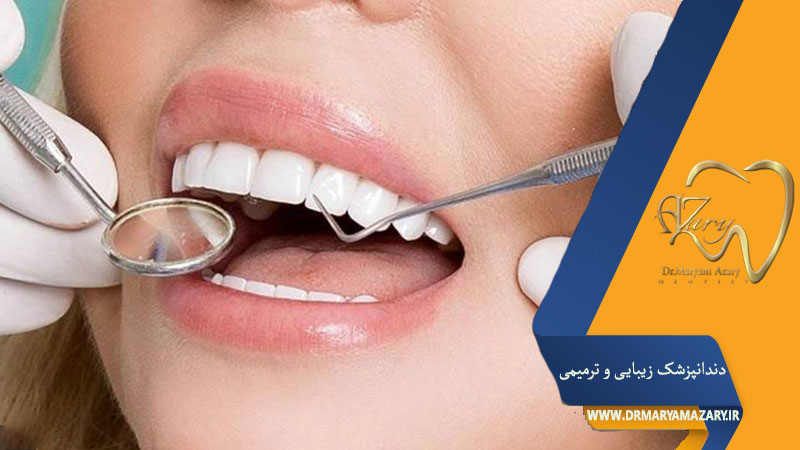 کامپوزیت و لمینت دندان