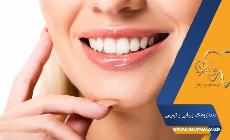 کامپوزیت یا لمینت یا روکش