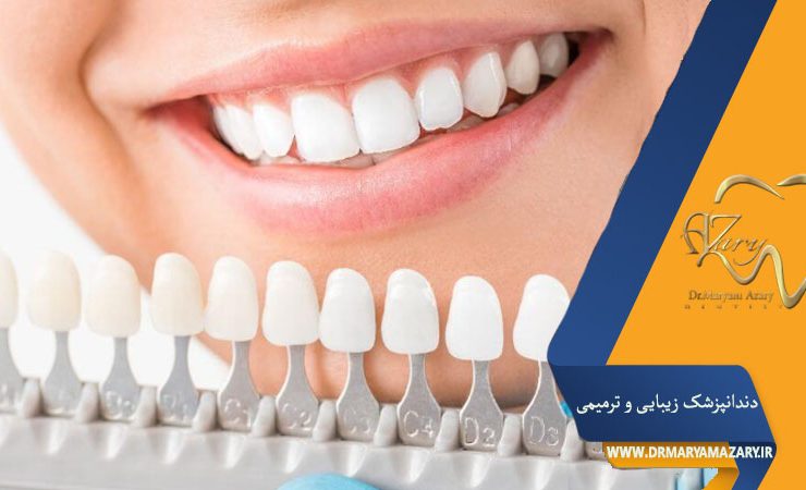 کامپوزیت یا لمینت دندان