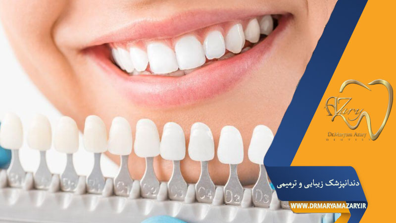 کامپوزیت یا لمینت دندان