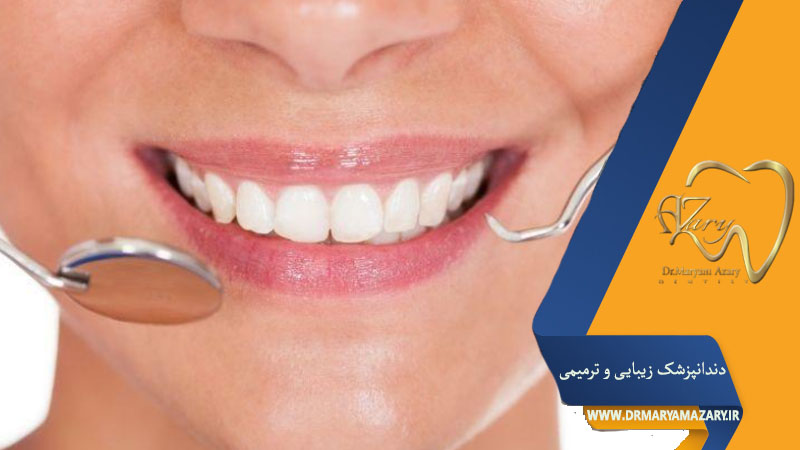 کامپوزیت دندان یا لمینت