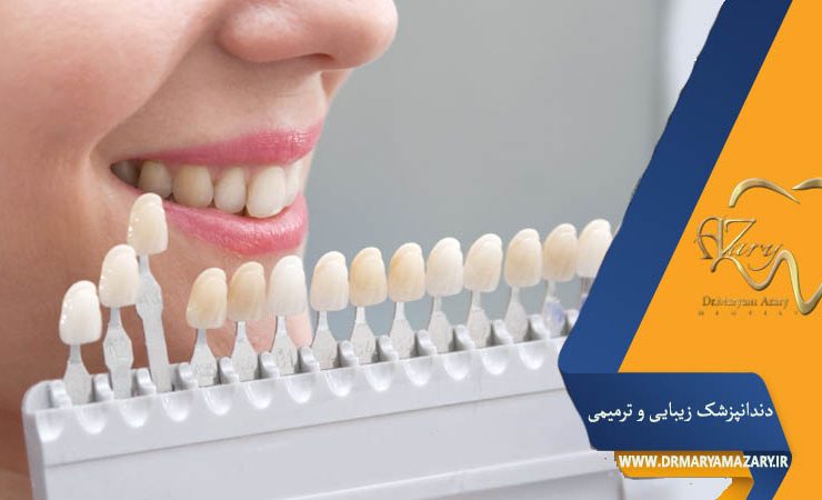 کاربرد لمینت دندان