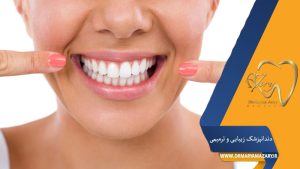 لمینت متحرک دندان