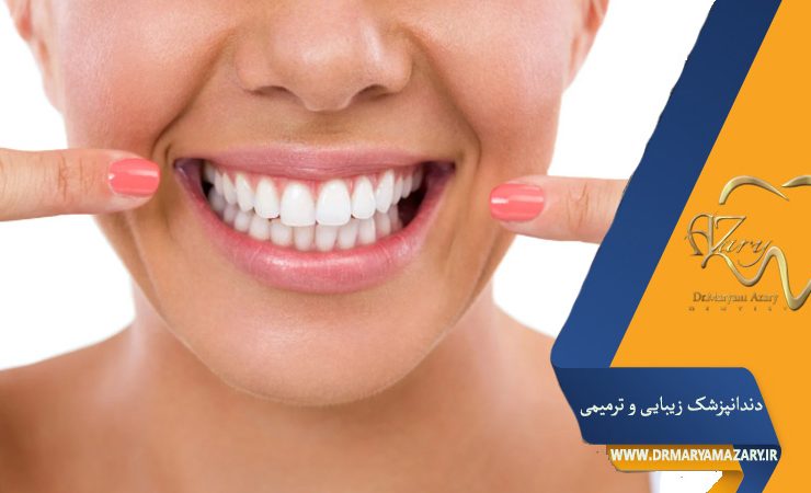 لمینت متحرک دندان