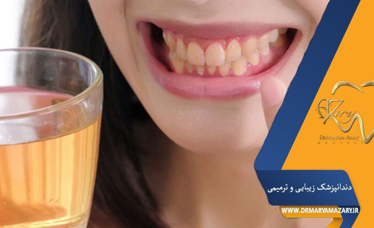 تاثیر چای بر رنگ ایمپلنت دندان