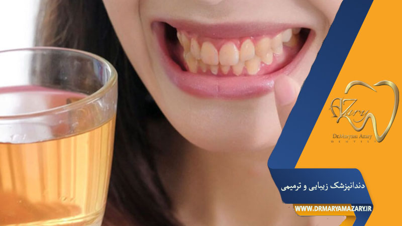 تاثیر چای بر رنگ ایمپلنت دندان