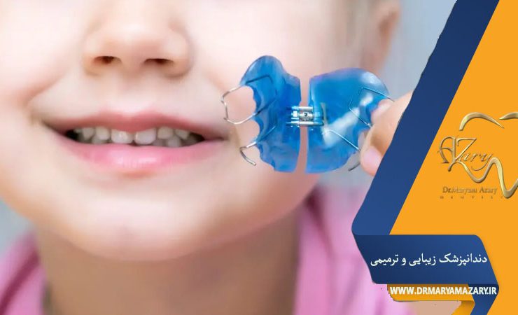 پلاک ارتودنسی کودکان
