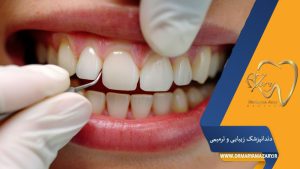 ترمیم دندان جلو پس از پوسیدگی