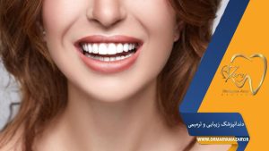 پشیمانی از انجام لمینت دندان