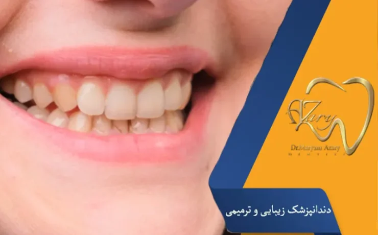 چه عواملی باعث زرد شدن دندانها میشود؟