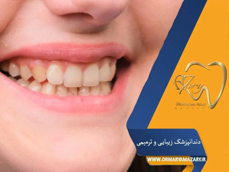 چه عواملی باعث زرد شدن دندان‌ها می‌شود؟