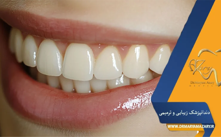 اصلاح لبخند لثه‌ای