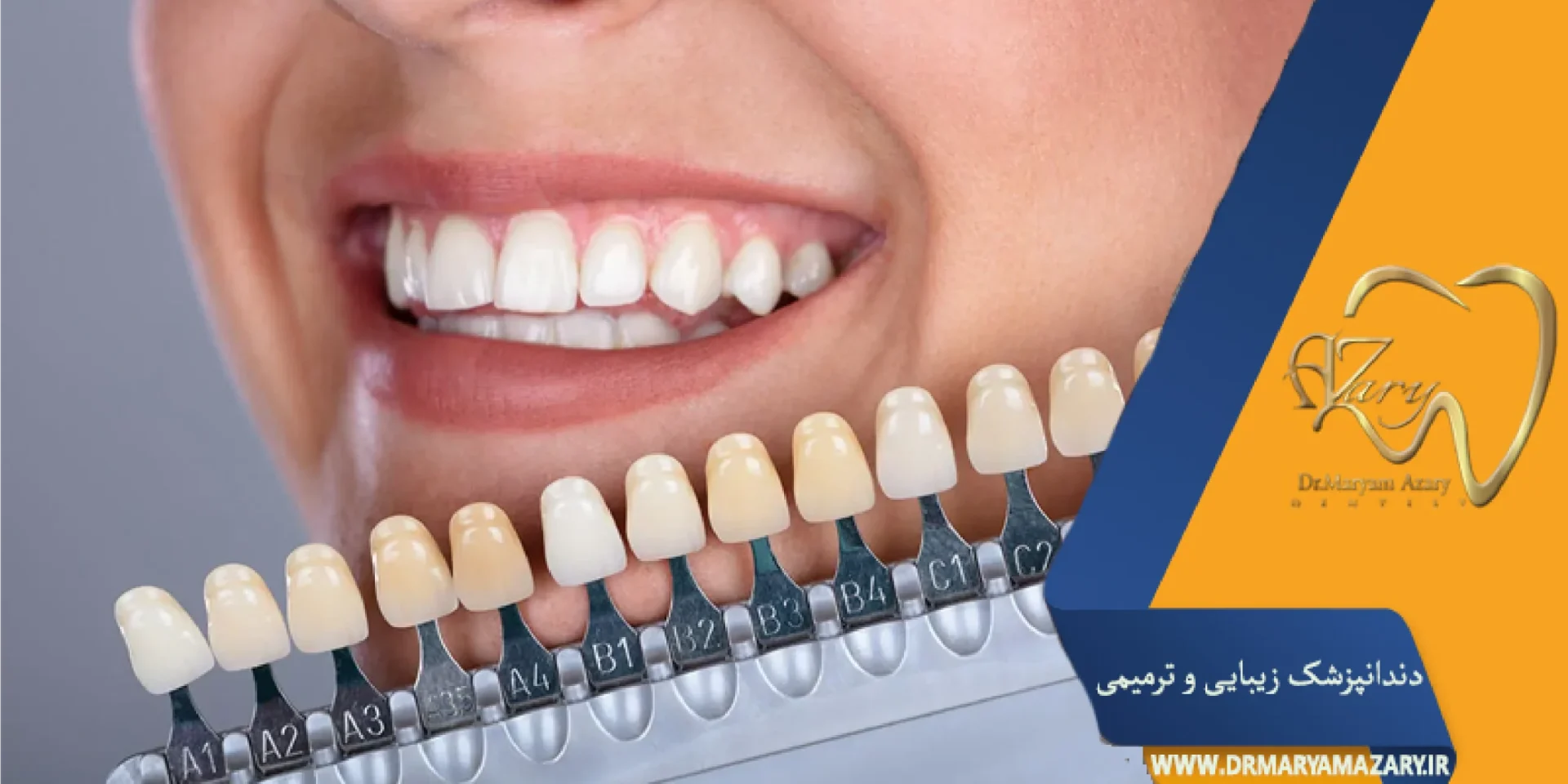 رنگ طبیعی برای کامپوزیت