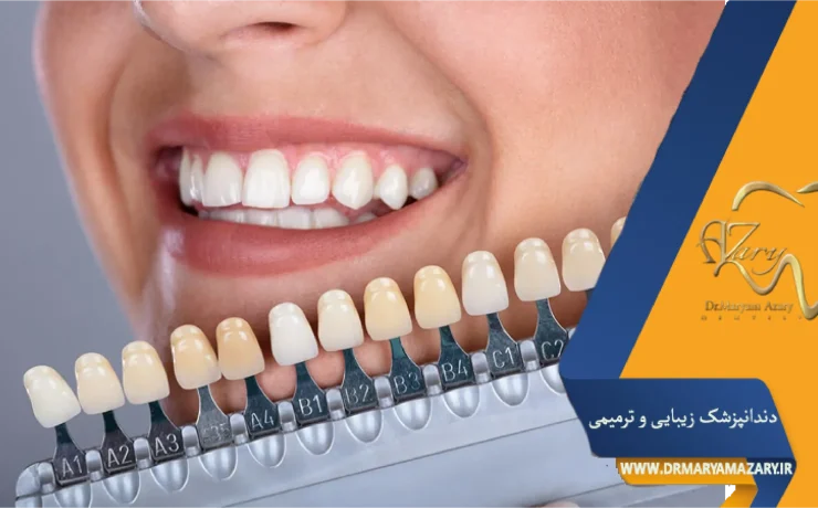 رنگ طبیعی برای کامپوزیت
