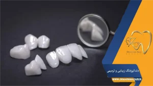 مراقبت بعد از کامپوزیت