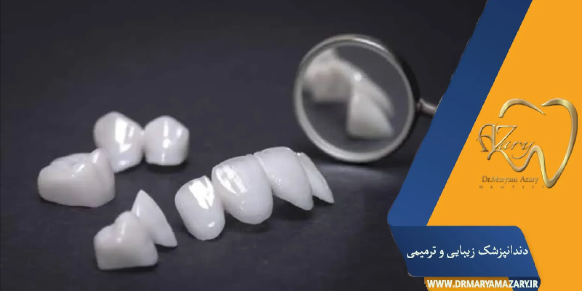 مراقبت بعد از کامپوزیت