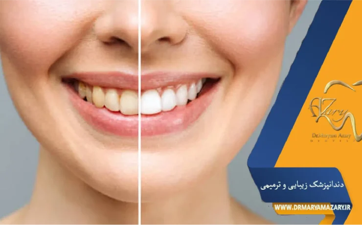 معاینات قبل‌از اصلاح لبخند