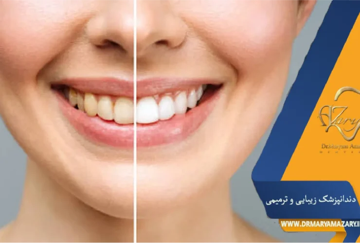 معاینات قبل‌از اصلاح لبخند
