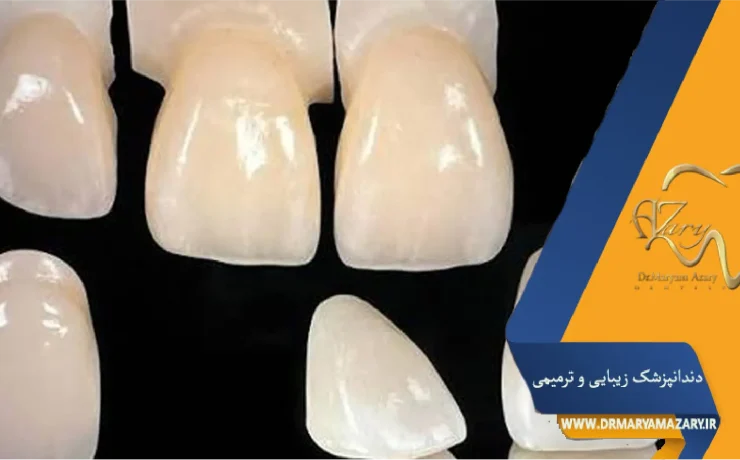 چرا ترمیم‌دندان می‌افتد